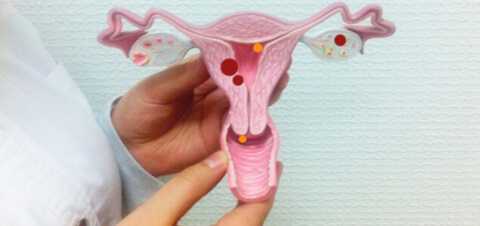 Дисплазия шейки матки