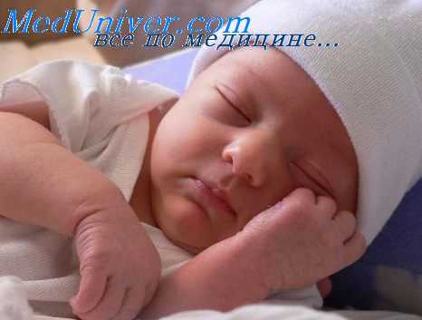 предуктальная коарктация аорты