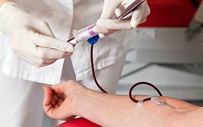 Дискретный плазмаферез - клиника Угодие