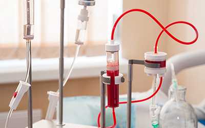 Процедура плазмафереза - клиника Угодие