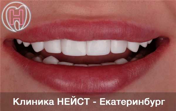 kompositnye-viniry-Ekaterinburg-photo6