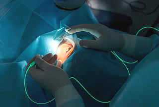 Операции на сетчатке глаза в Москве