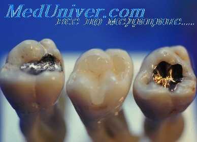 протез нижней челюсти