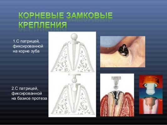 замковые крепления