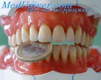 кламмерный протез