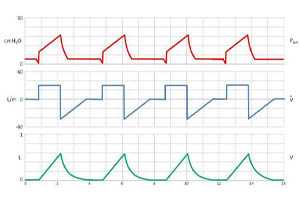 Отлучение пациента от ИВЛ при коронавирусной инфекции