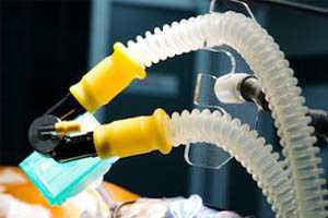 Методика отлучения от ИВЛ