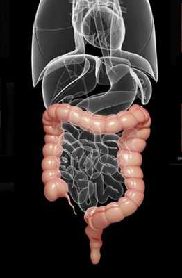 Рак прямой кишки