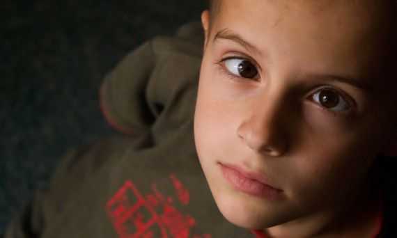 Амблиопия или