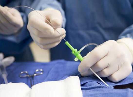 Радиочастотная абляция почечных артерий