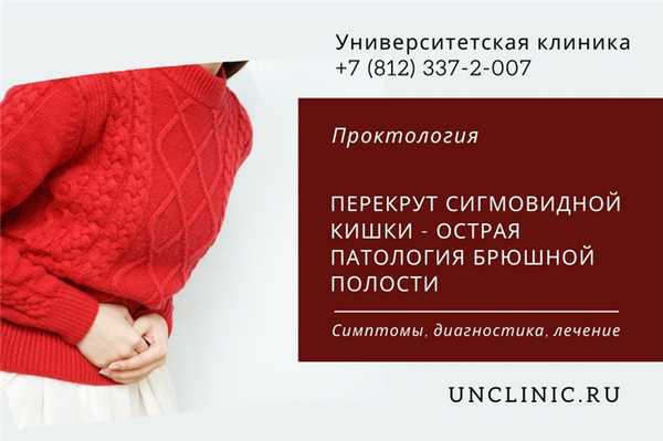 You are currently viewing Перекрут сигмовидной кишки - симптомы, диагностика, лечение