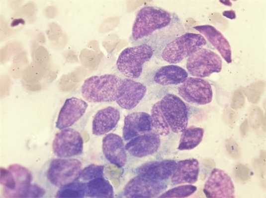 Рис.1 Цитологическое исследование