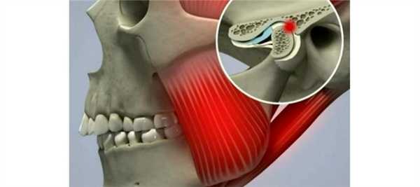 Рентген кистей рук