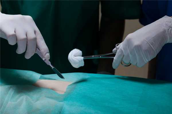 Методы лечения: оперативное вмешательство с наркозом