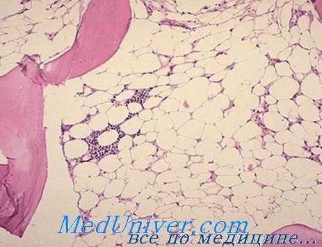 костный мозг при апластической анемии