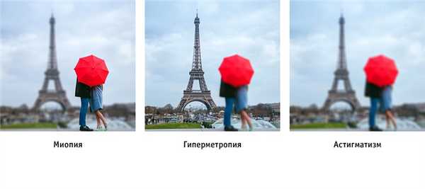 дальнозоркость симптомы