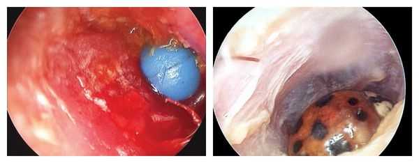 Шагаева (Саидова) Бурлият Солтанпашаевна, лор - Екатеринбург