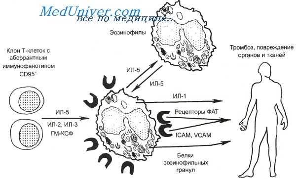 гиперэозинофильный синдром