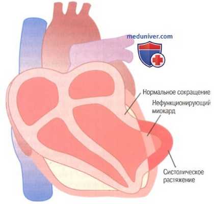 Кровоток в скелетных мышцах. Регуляция кровотока в мышцах