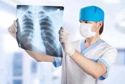 Рентгенограмма легких