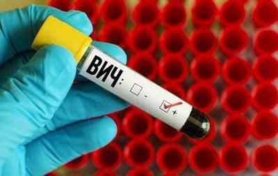 Положительный тест на вич