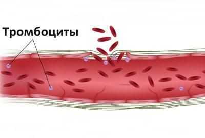 Плохая свертываемость крови