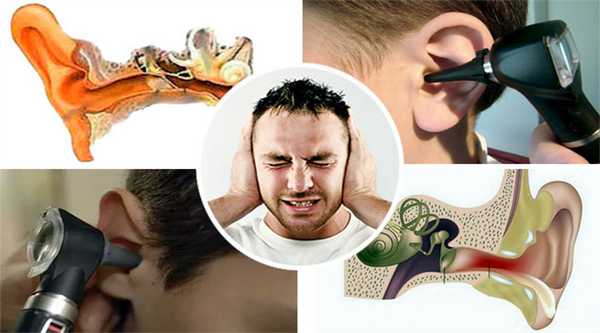 Кондуктивная тугоухость - осмотр