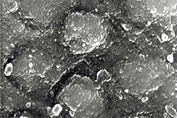 Рис. 4. Продукты рекристаллизации после кислотного травления эмали.