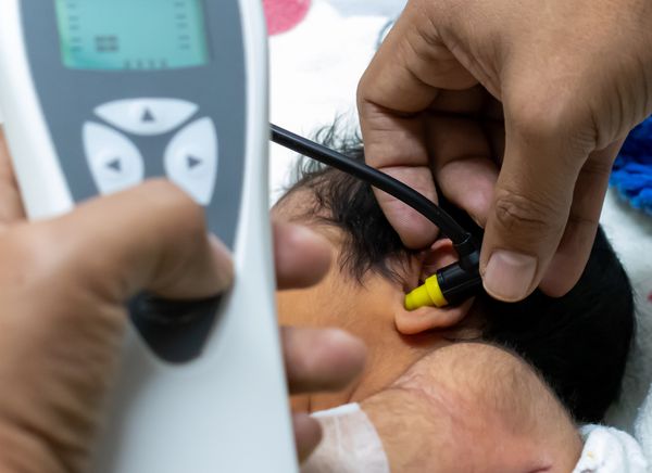 Аудиологический скрининг