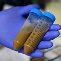 Лямблиоз - исследование кала