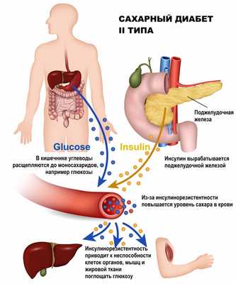 Диабет 2.jpg