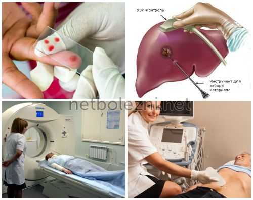 Инструменты для диагностирования печеночных проблем