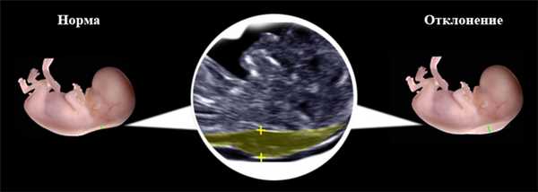 Норма и отклонение