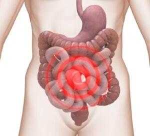 Воспаление кишечника