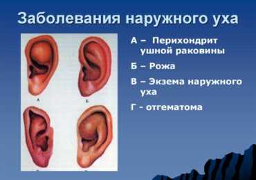Воспалительные заболевания наружного уха