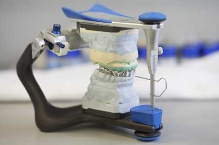 Артикулятор