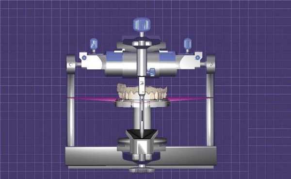Цифровая лицевая дуга и дентолицевой анализатор: от 2D к 3D анализу улыбки