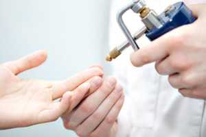 Криодеструкция