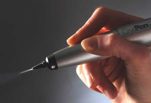 Прибор для криодеструкции