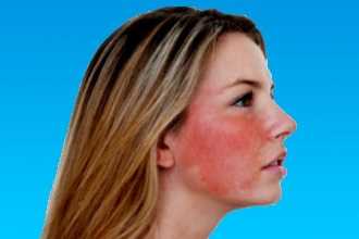 Причины замедления внутрипредсердной проводимости