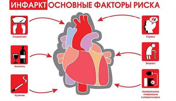 Инфаркт Факторы риска