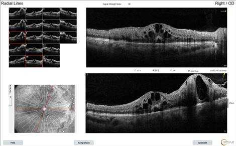 _Grigoryan_Raisa__27713_Radial Lines_OD_2020-07-10_13-21-14_F_1976-03-25_Main Report