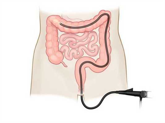 Колоноскопия