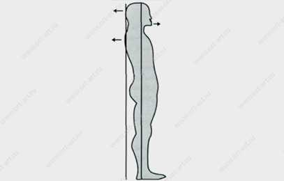 Характерная для мезиального прикуса осанка