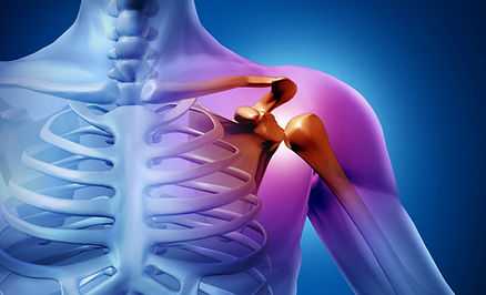 Плечо.ру-привычный вывих плеча. Артроскопия плеча при вывихе