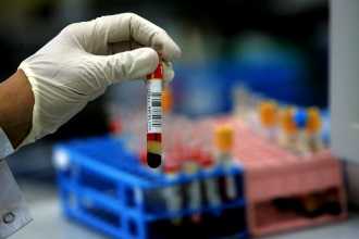 Как выявить септический эндокардит