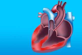 Септический эндокардит