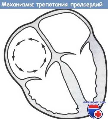 Механизмы трепетания предсердий