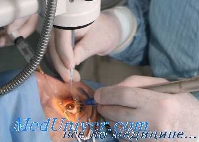 эндогенный эндофтальмит