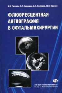 Флюоресцентная ангиография в офтальмохирургии
